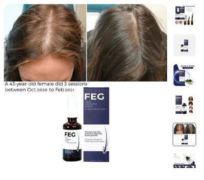 FEG Hair Growth Spray for Thicker, Fuller Hair – Organic Hair Loss Solution for Men & Women (50ml)